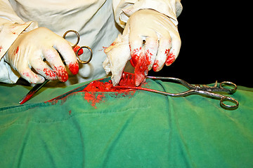 Image showing Surgery