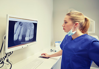 Image showing dentist with x-ray on monitor at dental clinic