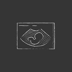 Image showing Fetal ultrasound. Drawn in chalk icon.
