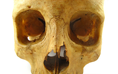 Image showing skull