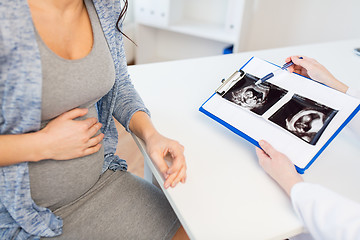 Image showing close up of doctor and pregnant woman ultrasound