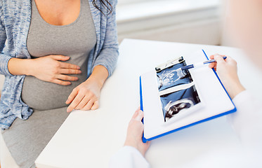 Image showing close up of doctor and pregnant woman ultrasound