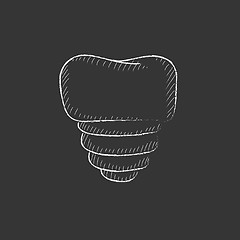 Image showing Tooth implant. Drawn in chalk icon.