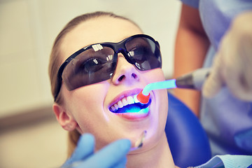 Image showing close up of woman patient with dental curing light