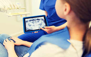 Image showing dentist showing x-ray on tablet pc to patient girl