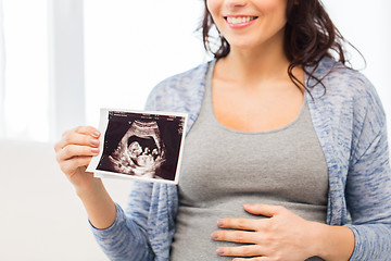 Image showing close up of pregnant woman with ultrasound image