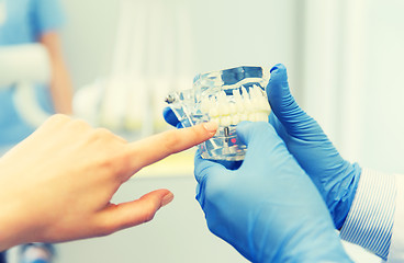 Image showing close up of dentist hands with teeth or jaw model