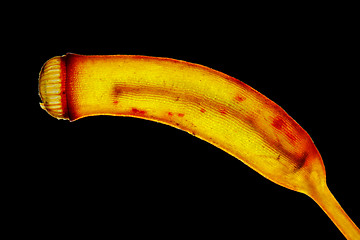 Image showing Mature moss sporangium in polarized light