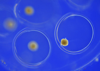 Image showing Freshwater snail eggs