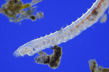 Image showing Microscopic view of Oligochaete worm