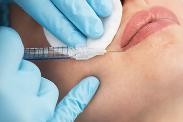 Image showing woman gets injection in her lips