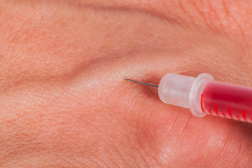 Image showing Subcutaneous medical injection concept