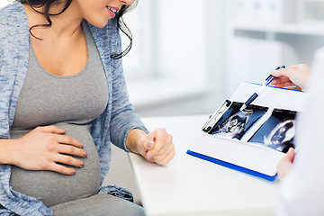 Image showing close up of doctor and pregnant woman ultrasound