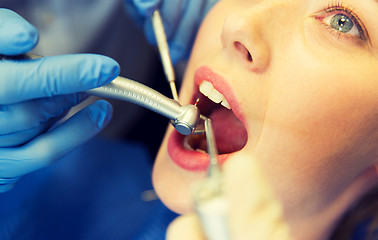 Image showing close up of patient having teeth treatment