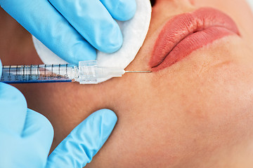 Image showing woman gets injection in her lips