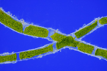 Image showing Microscopic view of green algae (Cladophora) cells