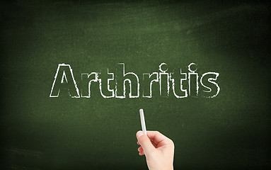 Image showing  Arthritis