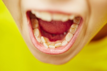 Image showing Teeth