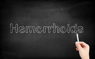Image showing Hemorrhoids