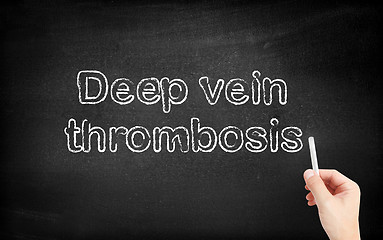 Image showing Deep Vein Thrombosis