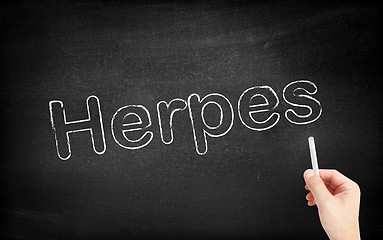 Image showing Herpes