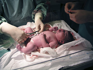 Image showing Newborn - Medical examination