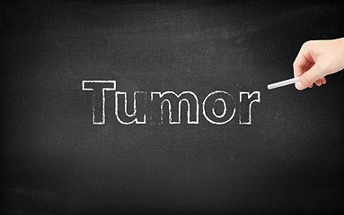 Image showing Tumor