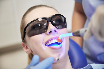 Image showing close up of woman patient with dental curing light