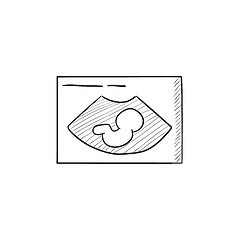 Image showing Fetal ultrasound sketch icon.