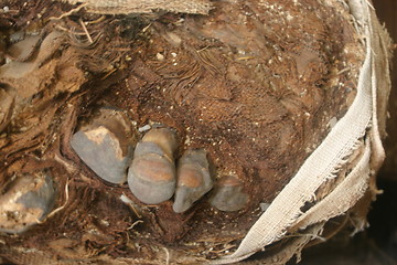 Image showing mummified toe