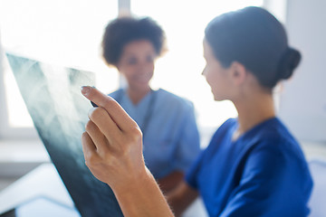 Image showing close up of doctors with x-ray image at hospital