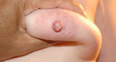 Image showing Breast Exam