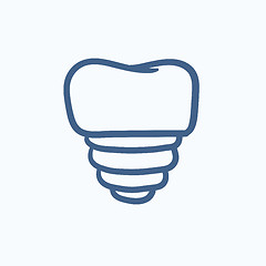 Image showing Tooth implant sketch icon.