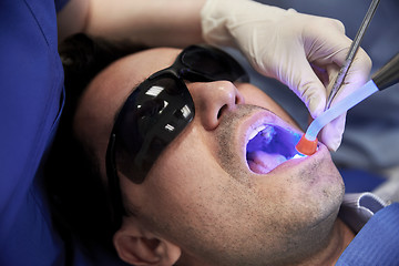 Image showing close up of male patient with dental curing light