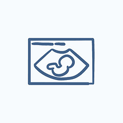 Image showing Fetal ultrasound sketch icon.