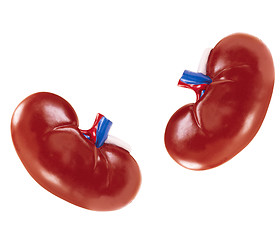 Image showing artificial kidney