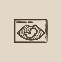 Image showing Fetal ultrasound sketch icon.