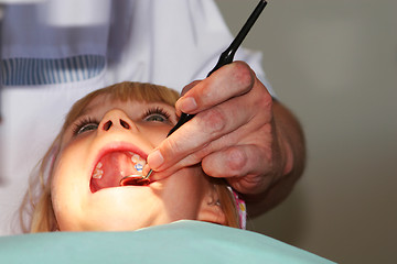 Image showing teeth with the blues