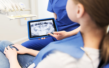 Image showing dentist showing x-ray on tablet pc to patient girl