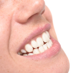 Image showing woman crooked teeth