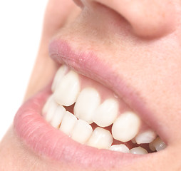 Image showing woman crooked teeth