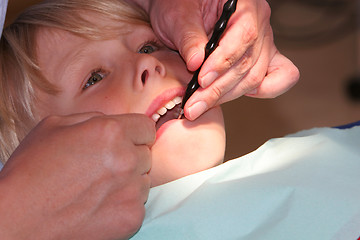 Image showing Dental repairs