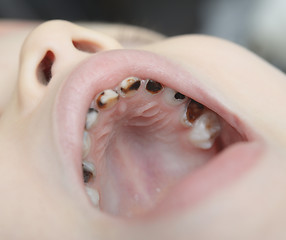 Image showing baby open mouth
