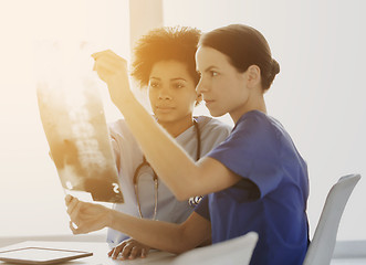 Image showing doctors with x-ray image of spine at hospital