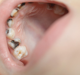 Image showing baby open mouth