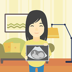 Image showing Pregnant woman with ultrasound image.