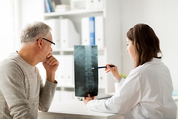 Image showing doctor with spine x-ray and senior man at hospital