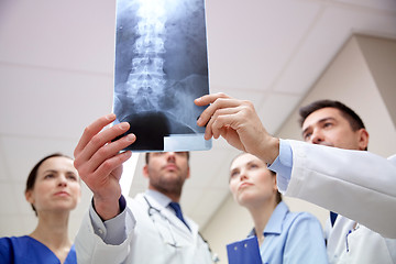 Image showing group of medics with spine x-ray scan at hospital