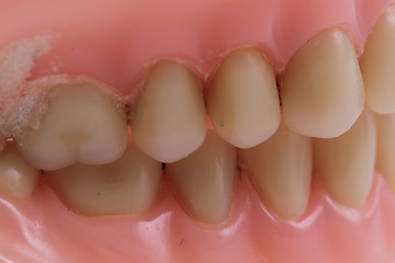 Image showing detail plastic teeth