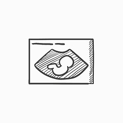 Image showing Fetal ultrasound sketch icon.